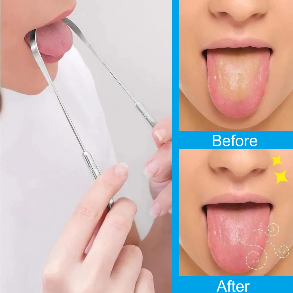 Professional Surgical Grade Stainless Steel Tongue Scrapper